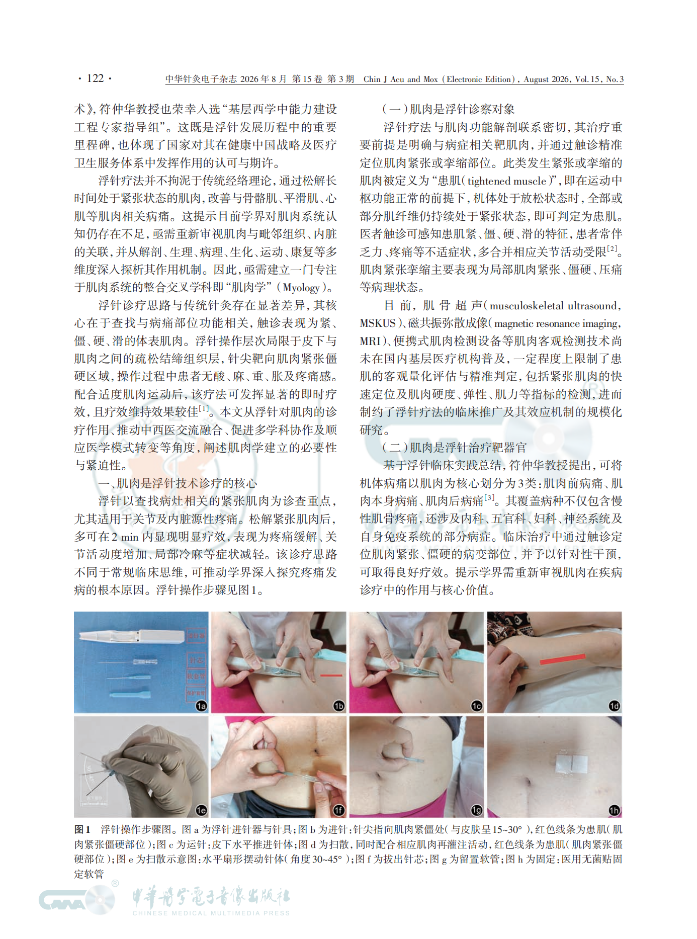 从浮针疗法看肌肉学建立的必要性和紧迫性(1)_02.png